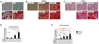 Inflammation and Mechanical Stress Stimulate Osteogenic Differentiation of Human Aortic Valve Interstitial Cells